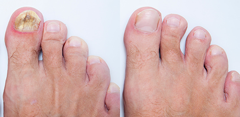 DERMATOLOGICKÉ INFORMÁCIE