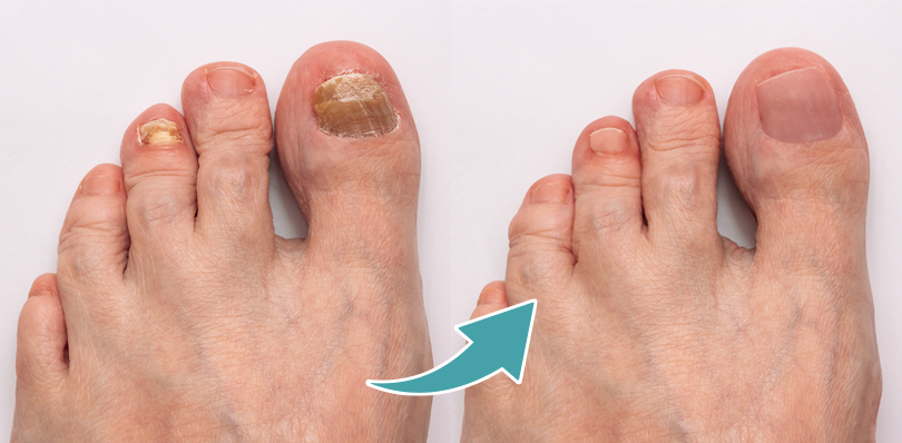 DERMATOLOGICKÉ INFORMÁCIE