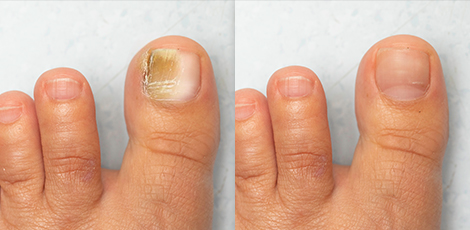 DERMATOLOGICKÉ INFORMÁCIE