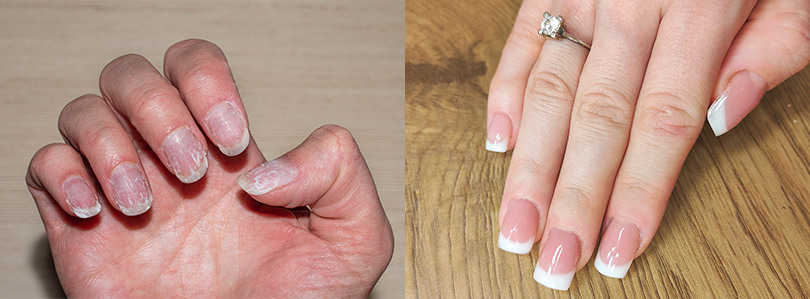 DERMATOLOGICKÉ INFORMÁCIE