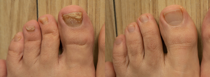 DERMATOLOGICKÉ INFORMÁCIE