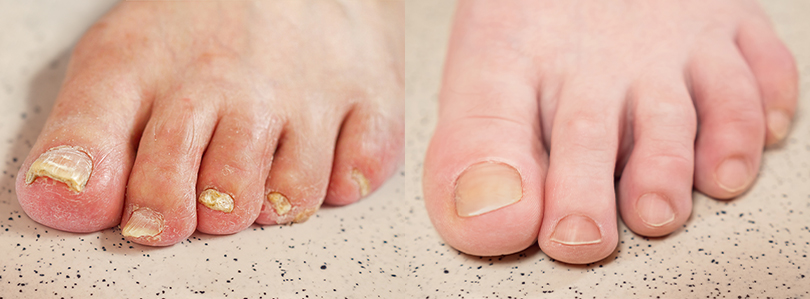 DERMATOLOGICKÉ INFORMÁCIE